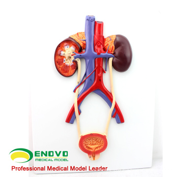 UROLOGY02(12422) Human Urogenital System, On Board, Anatomy Models > Medical Anatomy Urinary Models